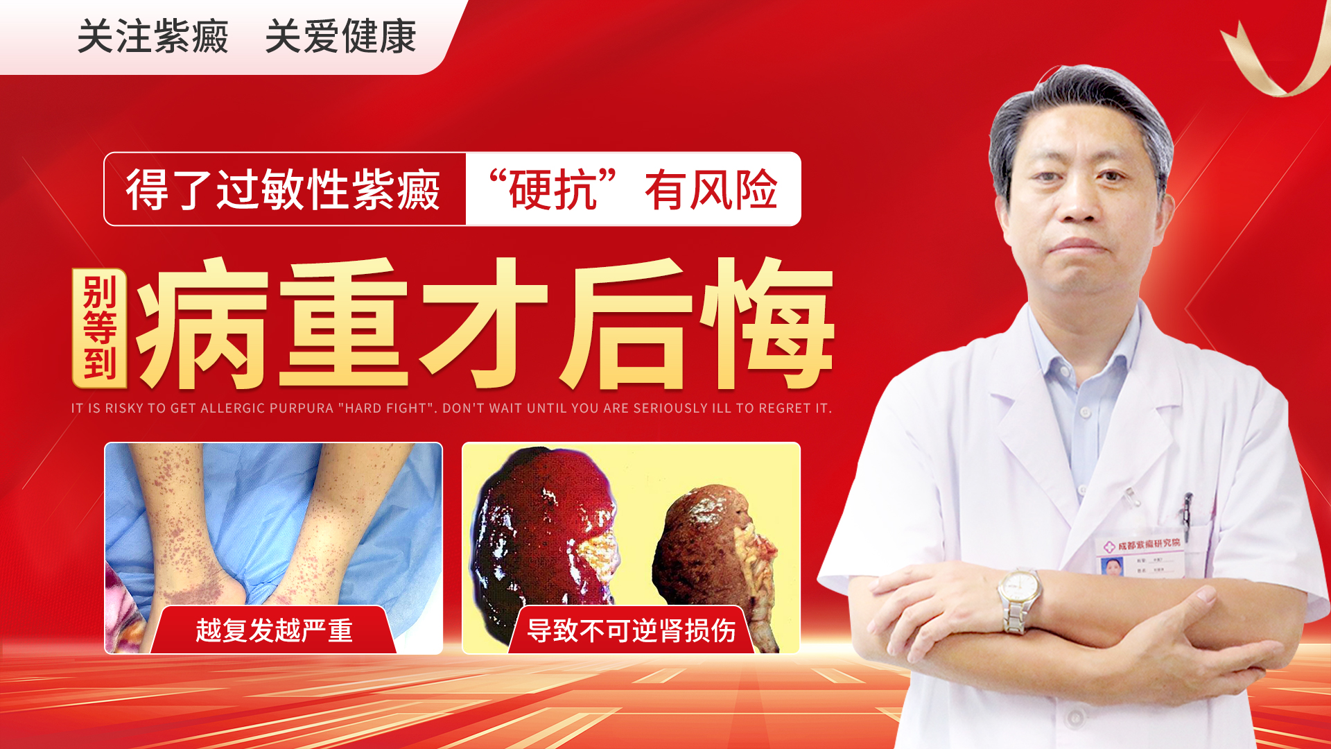 过敏性紫癜是如何一步步变成紫癜性肾炎的？一起来看看紫癜的“变脸史”